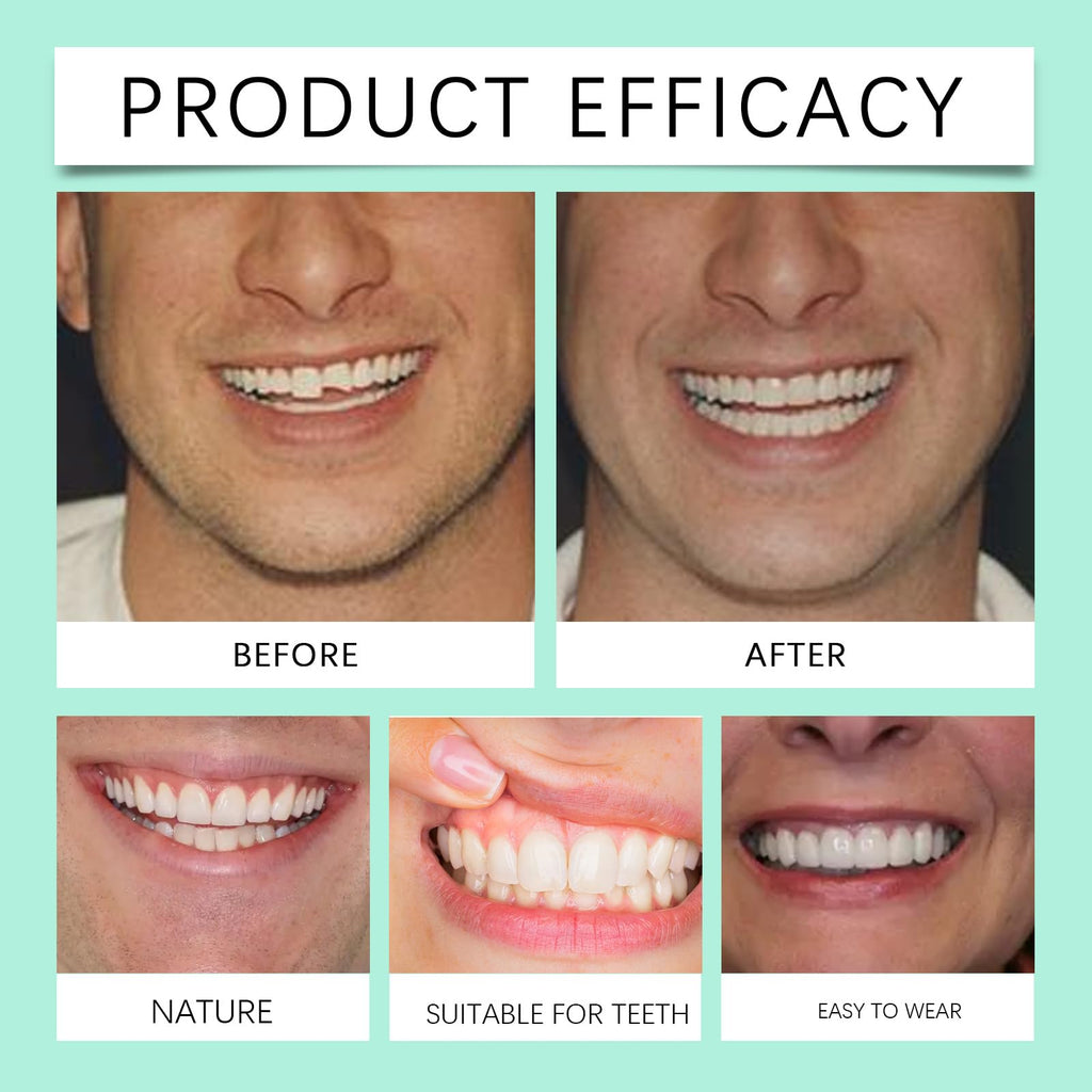 Soft Denture Silicone Veneers, Upper and Lower Denture Set K79055